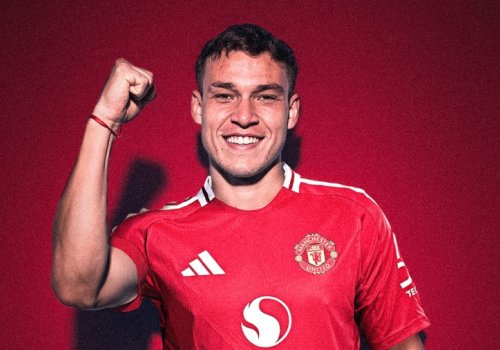 Uqarte A Seriyasına üz tuta bilər